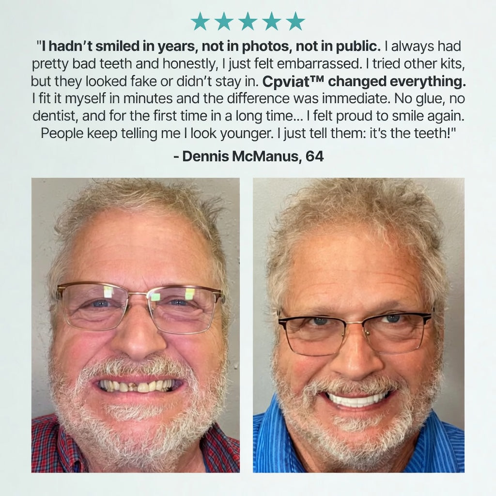 ✨Ends Today: 70% OFF! Cpviat™⏰ Custom-Fit Full Functional Dentures Make you more confident